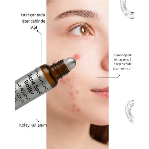 Villenature Acne ( Akne )Spot Roller 10 ml / Çay Ağaçlı Serum / Çelik Roller Başlık - Thumbnail 3